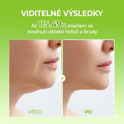 Cactox V-Lifting Mewing páska (4x maska v balení)