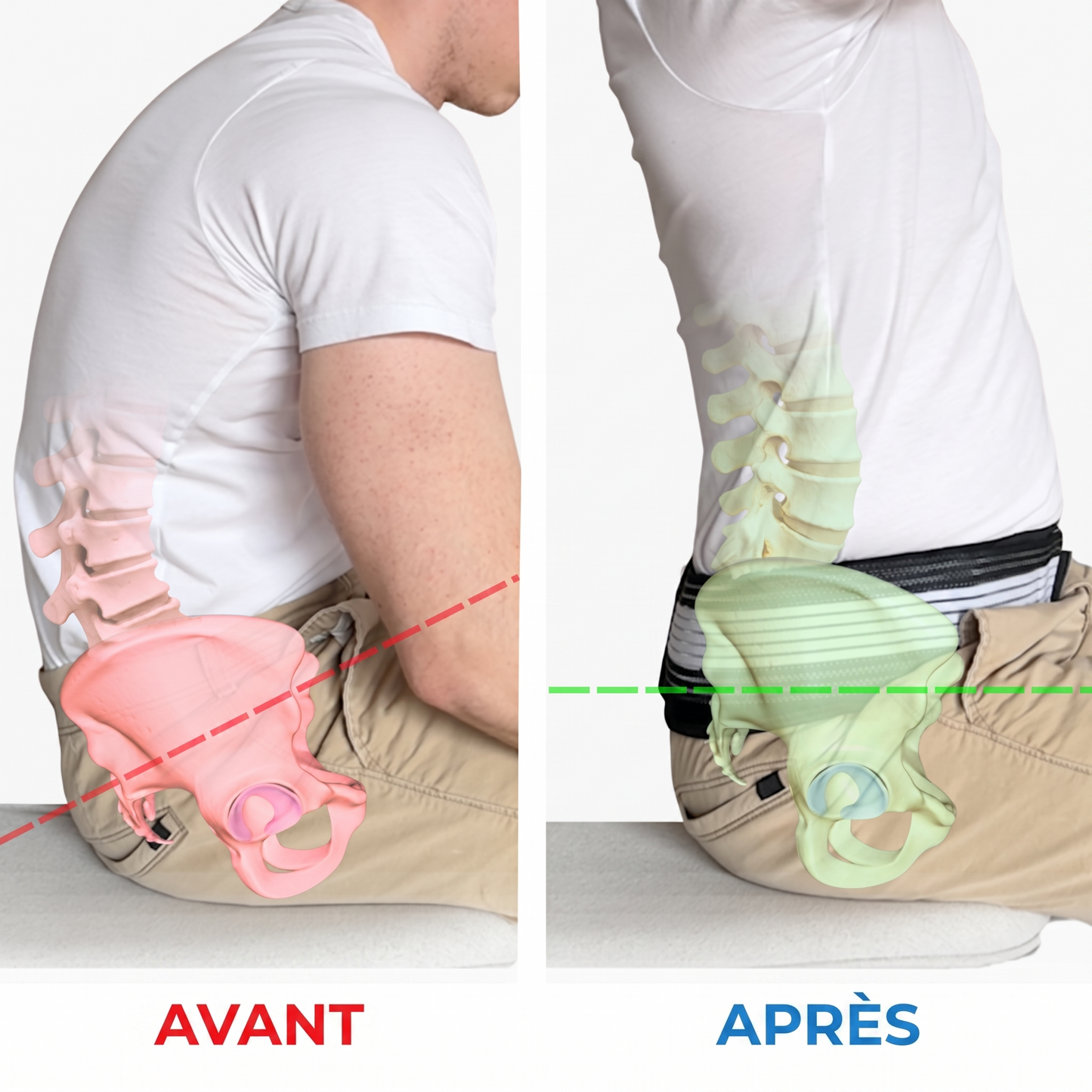 Ulivya Belt - soutien pour la sciatique et les douleurs lombaires