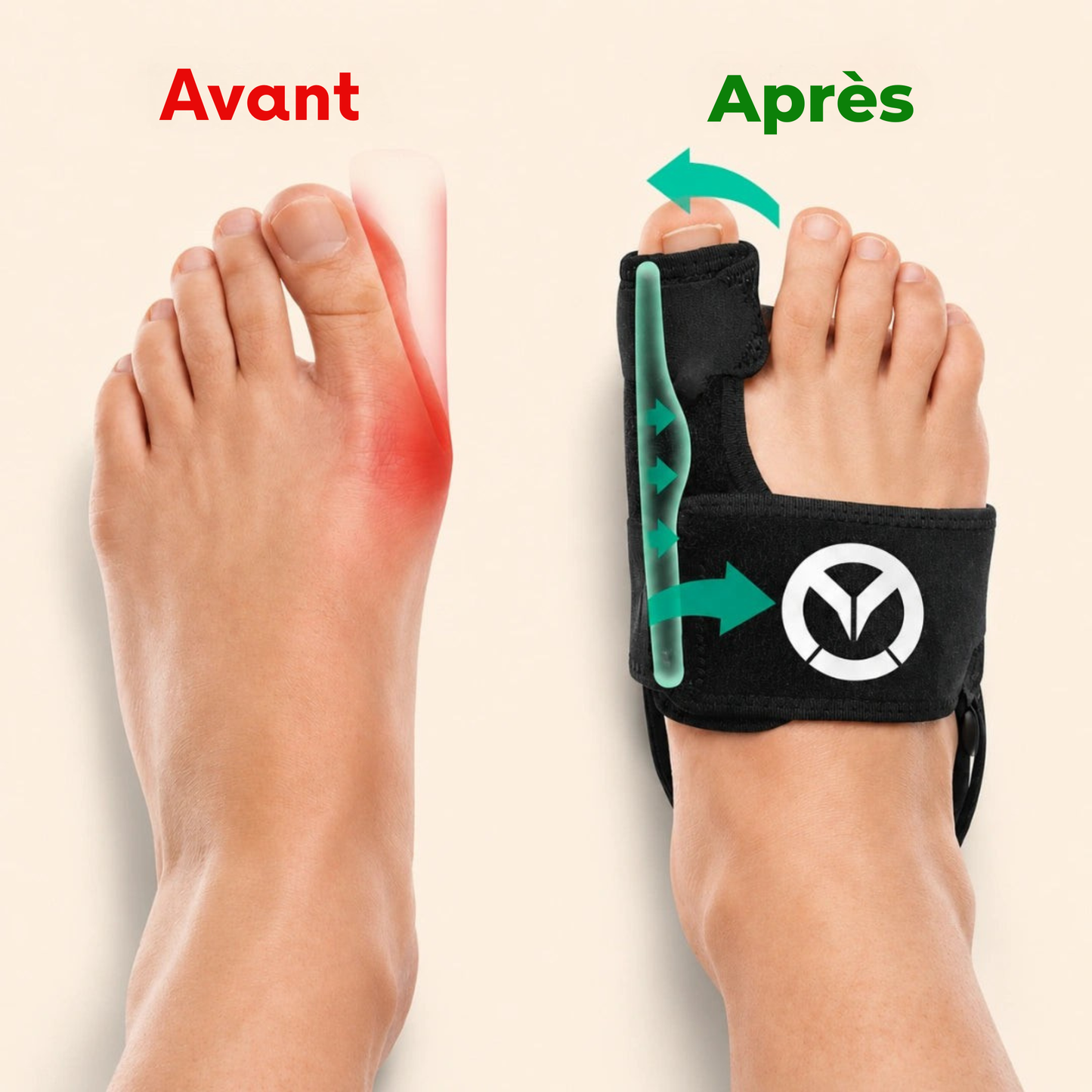 L'orthèse Valgus d'Ulivya
