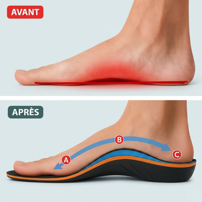 Ulivya™ – Semelles orthopédiques professionnelles