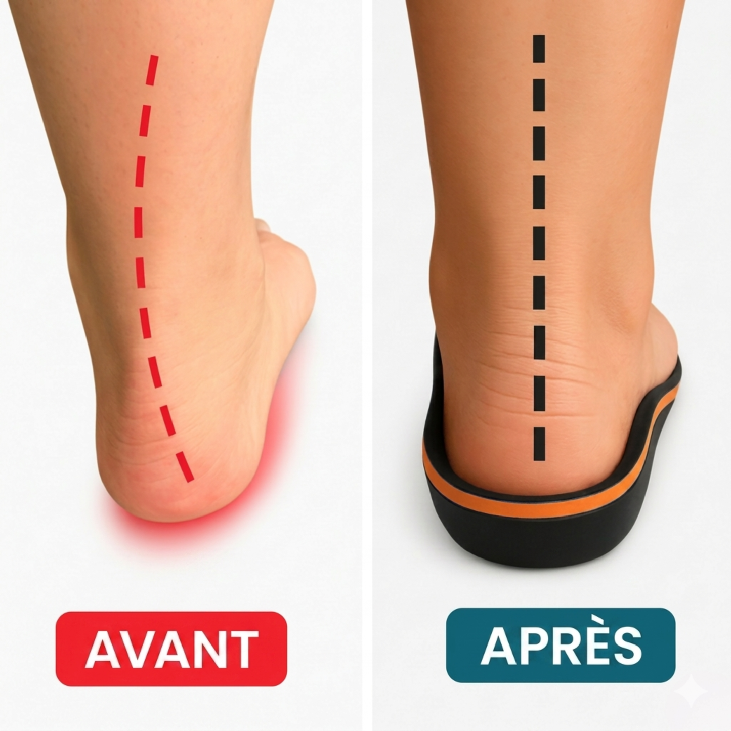 Ulivya™ – Semelles orthopédiques professionnelles