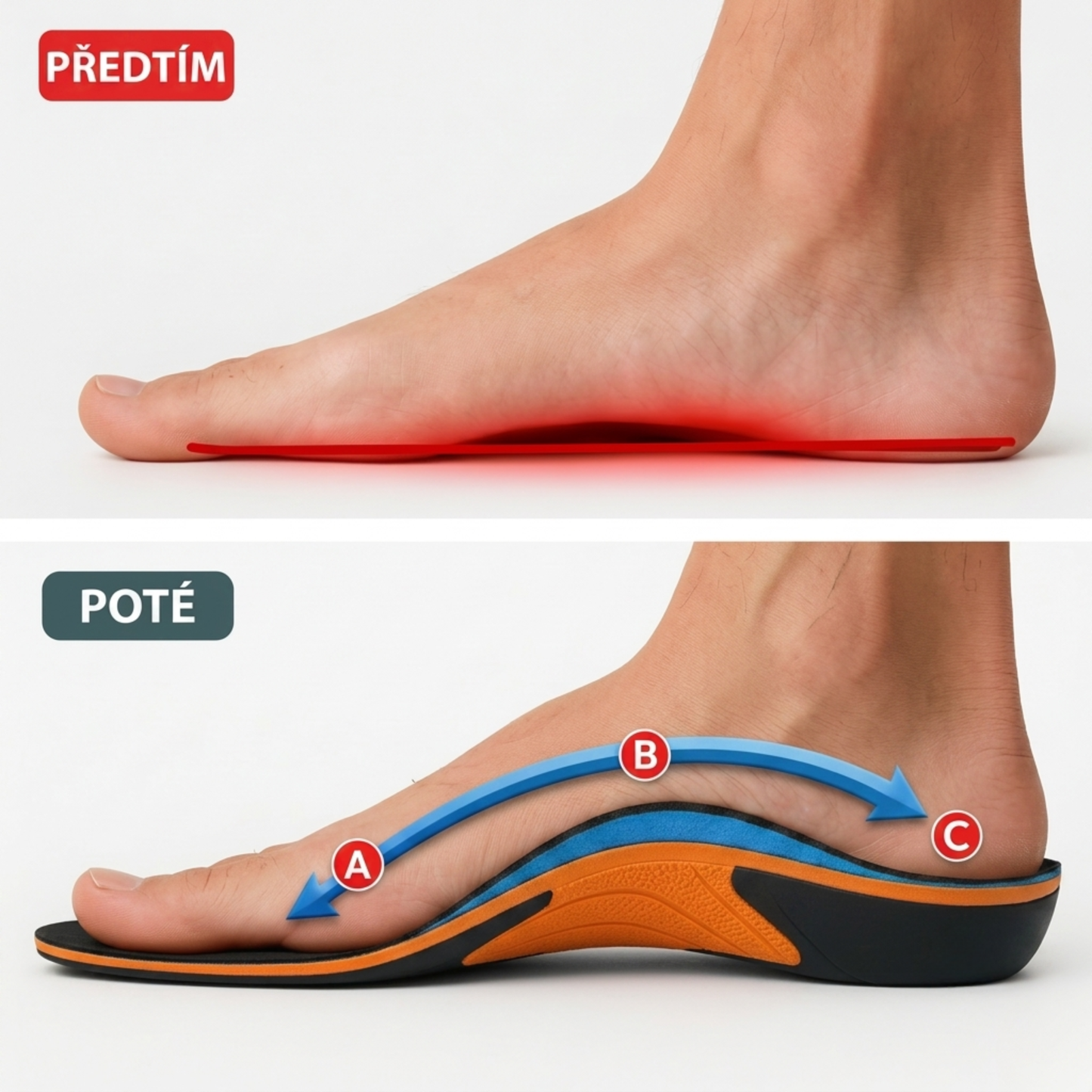 Ulivya™ – Profesionální ortopedické vložky