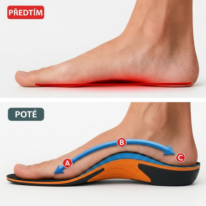 Ulivya™ – Profesionální ortopedické vložky