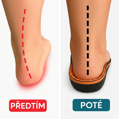 Ulivya™ – Profesionální ortopedické vložky