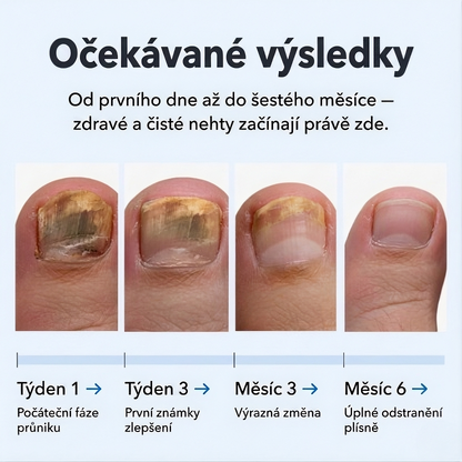 Zničte plíseň nehtů u kořene — ne jen na povrchu